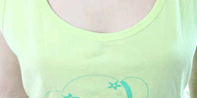 胸部假體取出術后