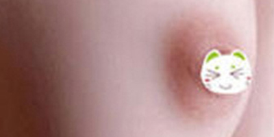乳暈漂紅術后