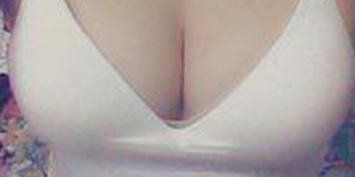 隆胸修復(fù)術(shù)前