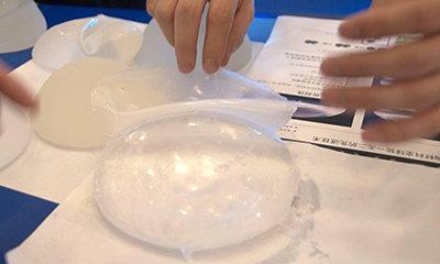 假體隆胸多少錢大概？假體隆胸多久能變軟？