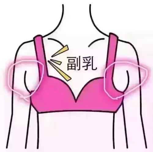 吸脂做副乳要多少錢？吸脂去副乳會(huì)反彈嗎？