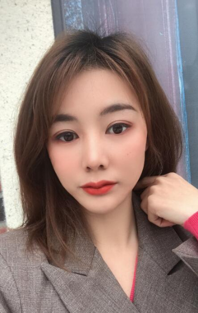 廈門華美名媛整形美容醫(yī)院做雙眼皮手術的最終效果