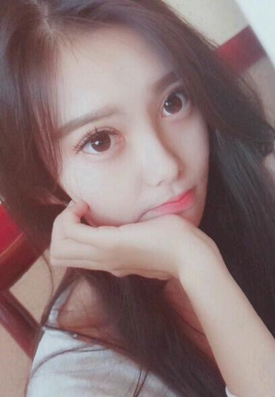 上海新健威醫(yī)療美容門診部張威雙眼皮案例效果分享