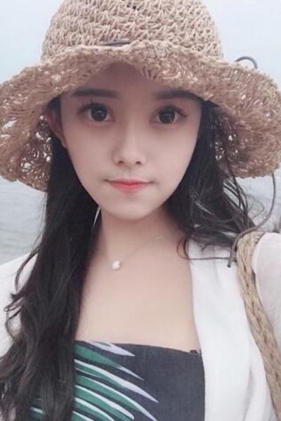 上海新健威醫(yī)療美容門(mén)診部做雙眼皮手術(shù)后三天的情況 上海新健威醫(yī)療美容門(mén)診部做雙眼皮手術(shù)后三天的情況