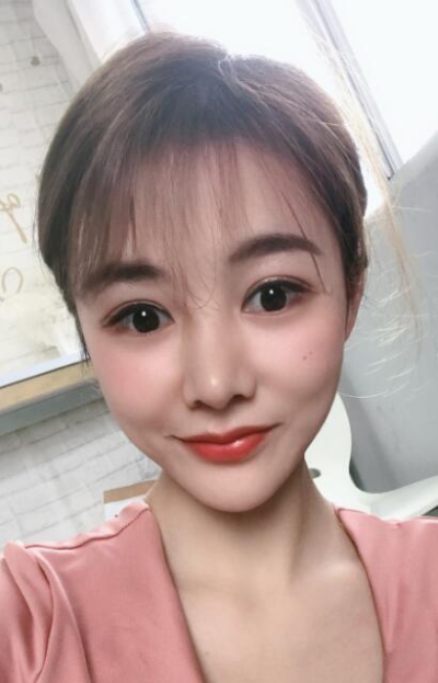 廈門華美名媛整形美容醫(yī)院做雙眼皮手術后的明亮雙眼