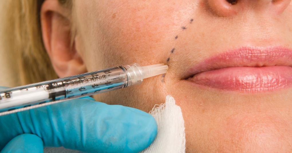 少女針是什么？少女針和玻尿酸填充哪個(gè)好？