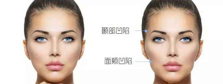 熱瑪吉做一次可以保持多久？熱瑪吉的原理和功效