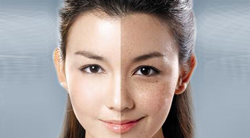 鐳射凈膚的原理功效 ？鐳射凈膚和m22是一種東西嗎？