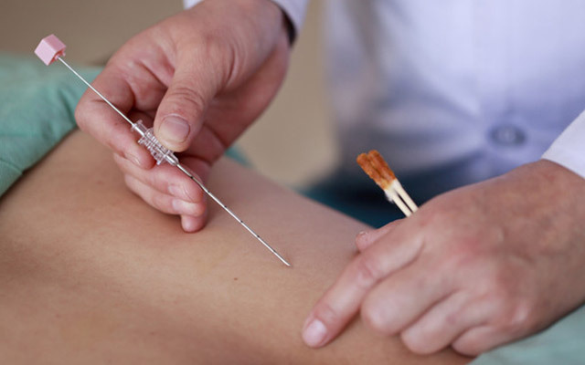 埋線減肥多少錢一次？埋線減肥多久才能有效果？