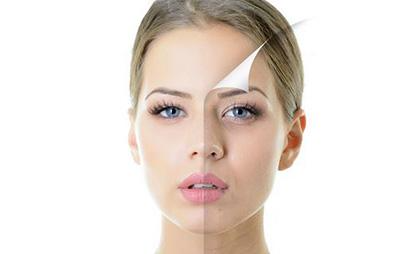 激光祛斑利弊是什么  激光祛斑吃什么有助于恢復(fù)