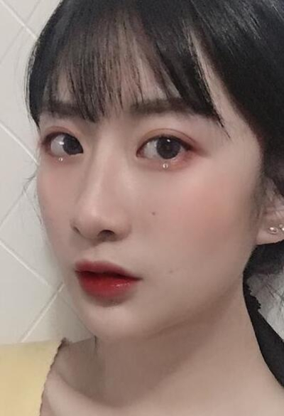 珠海陸達美容外科醫(yī)院做下頜角術后效果恢復的很好 珠海陸達美容外科醫(yī)院做下頜角術后效果恢復的很好