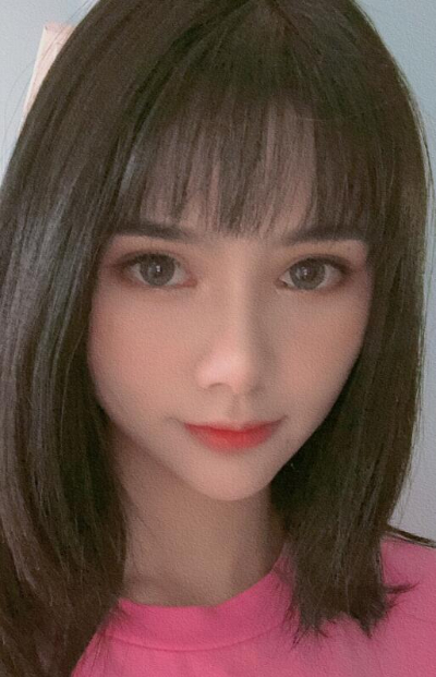 長春亞韓醫(yī)學(xué)美容醫(yī)院魏家賓面部吸脂案例效果分享