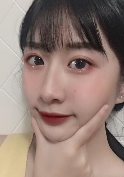 珠海陸達美容外科醫(yī)院做下頜角后完成小臉的蛻變 珠海陸達美容外科醫(yī)院做下頜角后完成小臉的蛻變