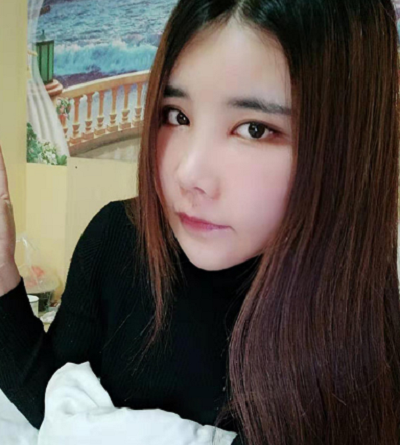 上海藝星醫(yī)療美容醫(yī)院做顴骨降低手術(shù)后去拆線情形