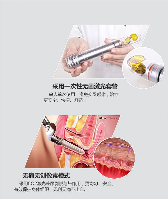 成都愛爾麗整形激光緊縮陰道怎么樣？激光緊縮陰道注意什么？