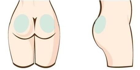 成都大華韓藝做臀部吸脂減肥安全性如何有什么特點？