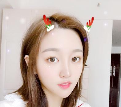 宜昌奧萊楊群申超體隆鼻案例術(shù)后一個(gè)月