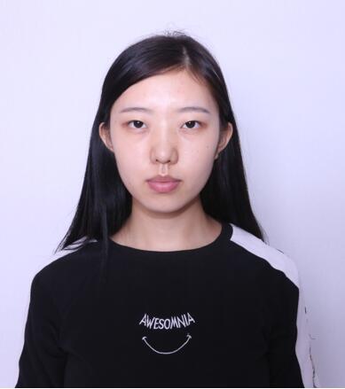 第四軍醫(yī)大學唐都醫(yī)院李望舟雙眼皮案例術前