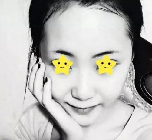 做綜合鼻，上海首爾麗格安建榮鼻綜合真人案例照片