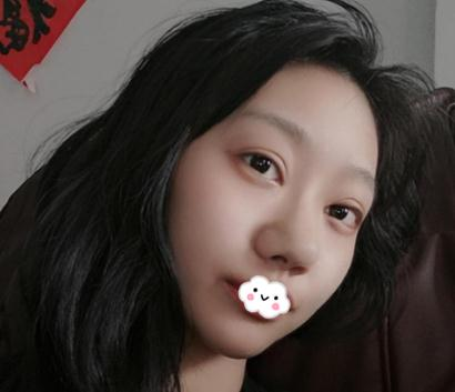 上海伊美爾港華做的3w的鼻子，你們說(shuō)值不值