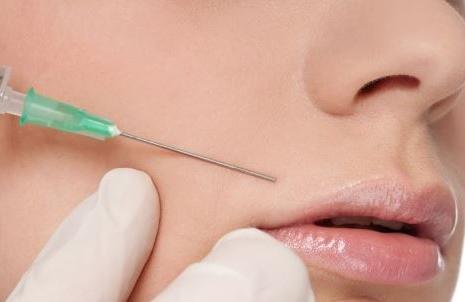 注射填充法令紋的方式有哪些？如何通過醫(yī)美手段祛法令紋？