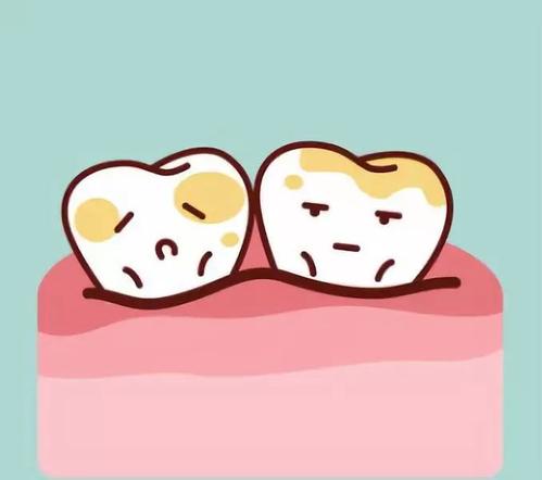 北京美年口腔噴砂潔牙怎么樣?噴砂潔牙與超聲波有何區(qū)別？