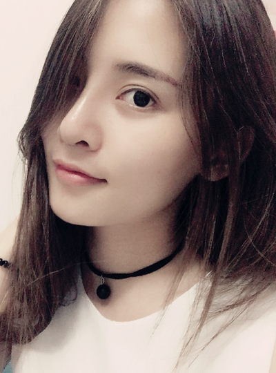 深圳微姿醫(yī)療美容門診部康壯為做鼻綜合案例效果分享