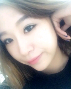 上海時(shí)光整形外科醫(yī)院做耳軟骨隆鼻術(shù)后最終狀態(tài)