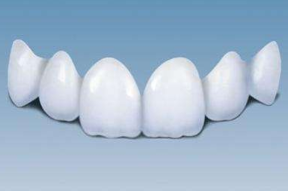 巴中華醫(yī)口腔二氧化鋯全瓷牙多少錢？二氧化鋯全瓷牙有何優(yōu)點(diǎn)？