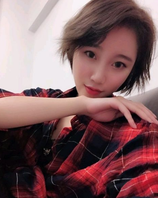 上海時光整形外科醫(yī)院做鼻綜合手術(shù)后的第三個月