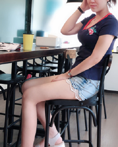 廈門(mén)海峽整形美容醫(yī)院做腰腹吸脂手術(shù)后的日常 廈門(mén)海峽整形美容醫(yī)院做腰腹吸脂手術(shù)后的日常