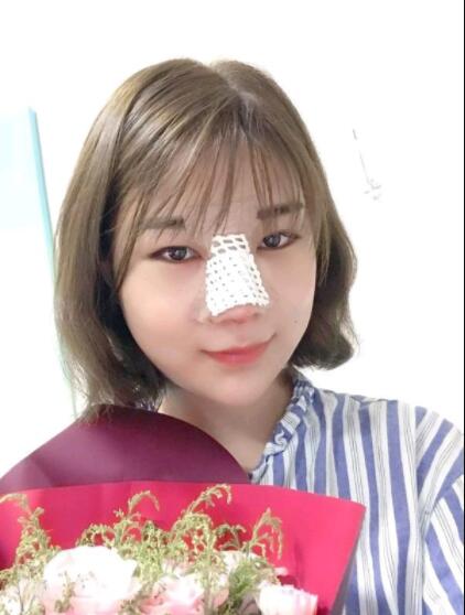 上海美萊醫(yī)療美容門診部做鼻綜合剛剛結(jié)束手術(shù)