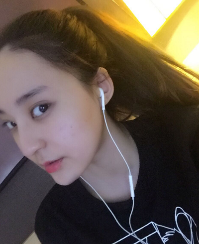 北京京民醫(yī)院（原釣魚(yú)臺(tái)醫(yī)院）整形外科做下頜骨手術(shù)后的最終效果